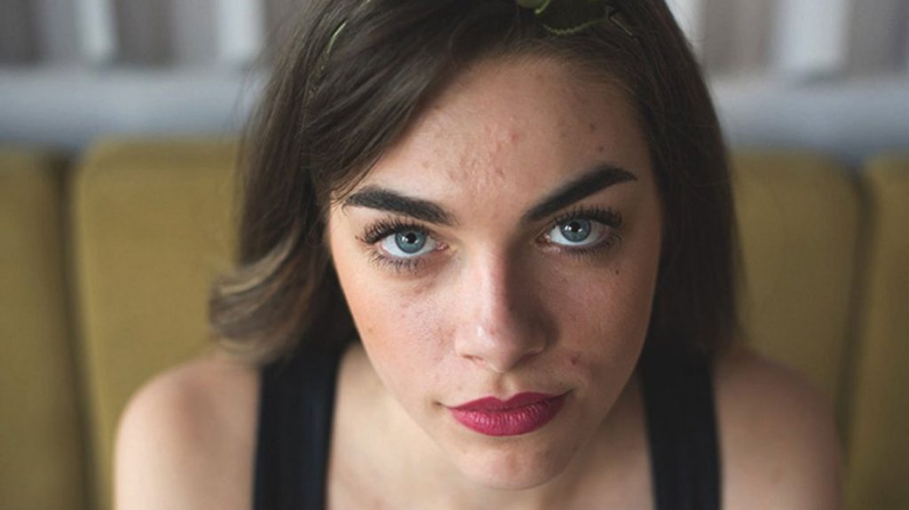 Men and women always have to face skin problems
