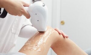 Advanced Hair Removal Treatment For All Skin Types